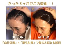 頭蓋骨 小顔矯正サロン グレースフィオーレ 札幌店(gracefiore)の雰囲気（国産高品質★ヒト幹細胞培養上清液で髪のお悩み/エイジングケア）