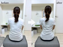 エーアール(AR)/【Before/After】