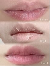 シェリー(Cherie)/ローマピンク 唇