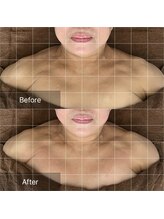 トニック バイ まつもと整骨院鍼灸院(Tonic)/★RF小顔のBefore After★