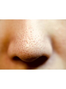 毛穴ケアをしたい