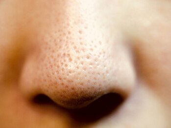 ハートフル ビューティー(HEARTFUL BEAUTY)の写真/【ハイドラフェイシャル】で毛穴よごれごっそり洗浄&毛穴レス肌へ!プレミアムコースで目立ちも解消♪