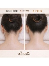 ルネル(Lunelle)/写真盛れするうなじ♪