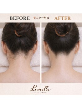 ルネル(Lunelle)/写真盛れするうなじ♪