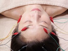 笑美福の雰囲気（電気を流す美容鍼）