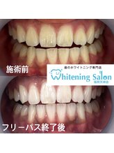 ホワイトニングサロン 福岡天神店