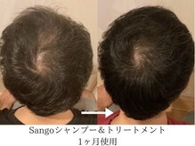 こもれび/頭皮ケアの変化