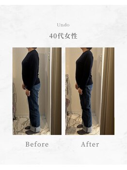 アンドゥ(Undo)/骨盤ゆがみ改善でまっすぐ整う