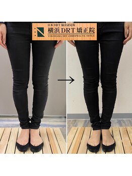 横浜DRT矯正院/O脚矯正