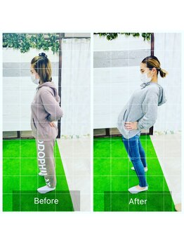 門前仲町イエティ鍼灸整骨院（旧：イエティ鍼灸整骨院）/産後ママさんの腰痛、骨盤矯正☆