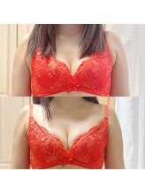 マイン(Mine)/魅せる美バストを叶える施術