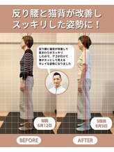 スペックフィジカルコンディショニング(SPECフィジカルコンディショニング)/60代女性/姿勢ビフォーアフター
