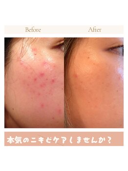 小さなおうちサロン こぐまの寝床/ビフォーアフター