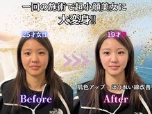 ミーアキャット 福岡天神(MEERKAT)/超小顔美女アスリートに大変身