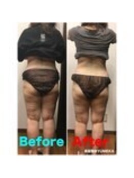 ユメカ 日の出院(YUMEKA)/骨盤ダイエット+骨盤ストレッチ