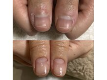 スリーエススタイルズ(3s Styles)/深爪ケア