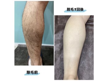 ルトゥール(Retour)/メンズ ひざ下