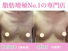 サラエクセレント 心斎橋(SARA EXCELLENT)/バストアップしてバージスライン