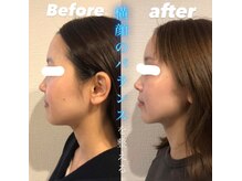 エム(M)の雰囲気（たるみ・二重あごに即アプローチ！小顔&リフトアップ実感◎）