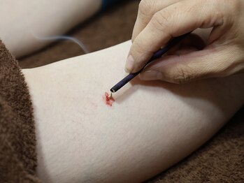 ティルナノーグイリニ(Tir Na Nog-EIRINI)/巡り、整う。八分灸の時間