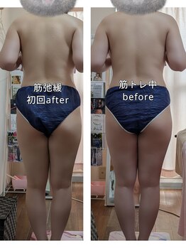 紬(TSUMUGI)/従来の筋肉は長細い　戻して細く
