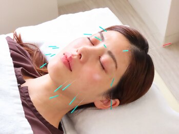 リキュア エスパース デ ボーテ 東京表参道店(ReCuA Espace de Beaute)の写真/少ない本数優しい刺激で速攻小顔へ！独自のツボと手技を使って整える至福のひとときを☆鍼が初めての方にも
