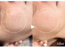 アリエルリッチ/美肌ケアBefore左→After右