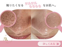 ミリ(mili)