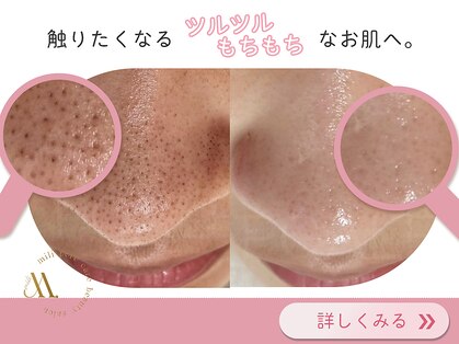 ミリ(mili)の写真