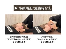 エヌ(N)/エラ張りは得意分野です！