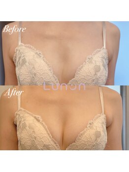 ルノン(Lunon)/【20代・ブラが浮く】バストケア