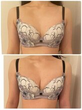 美人バスト 新潟店/ 【バストアップ★育乳】症例