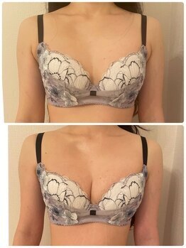 美人バスト 新潟店/ 【バストアップ★育乳】症例