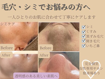 Gem 【ジェム】毛穴/ハーブピーリング/よもぎ蒸し/小顔/シミ/ニキビ【7/7開店(予定)】の写真