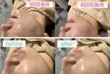 ジョイアビューティー(Gioia beauty)