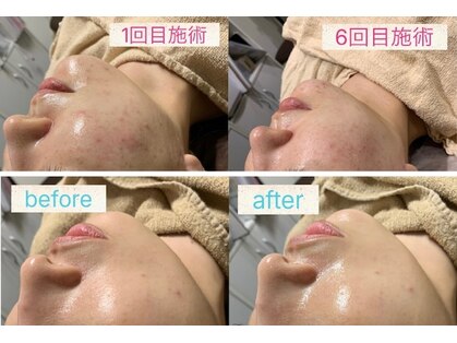 ジョイアビューティー(Gioia beauty)の写真