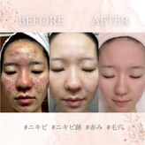 ザ フェース 天神店(THE FAITH)