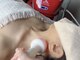 ルアナ(Luana)の写真/【ウルトラ小顔¥8580】イベント前に間に合わせたいならコレ!1度でお顔が小さく変化☆即リフトアップ!!