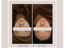 ミルトゥ(myrte)/Before→After ワイコ・オー