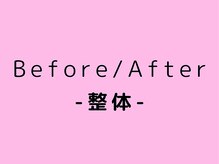 キトキト鍼灸接骨院 今里院/整体Before/After