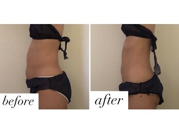 ベルシア(Bellucia)/