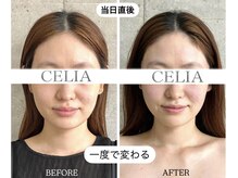 セリア(CELIA)
