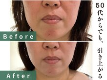 インヤン(yinyang)