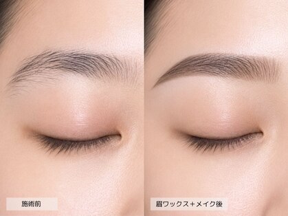 ゼロスリー(0.3s)の写真