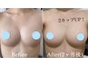 【人気No.1】全身バストアップ育乳美容整体60分　¥15,400