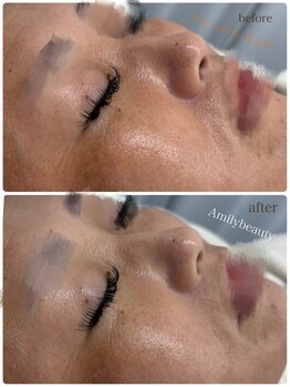 アミリービューティー ひたち野うしく店(Amily beauty)/フォーエバーヤング