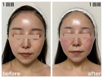 ダルセーニョ/小顔上昇！「幸せスパイラル◎」