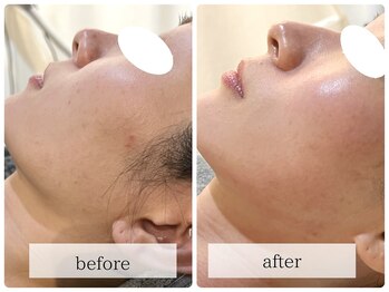 プールフツール(Pool Futur)