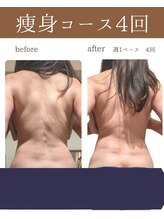 ソワンドメイ 四谷(SOIN DE MEI)/ダイエットモニター募集