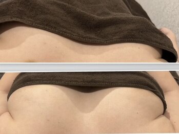 リフュージュ 隠れ家の写真/マシュマロ美乳《育乳キャビ×心地よさに合わせた強弱電流ハンドEMS》バストアップ&ボディラインも変化♪